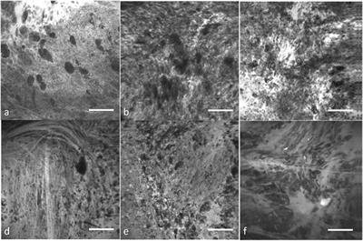 Prospects for Theranostics in Neurosurgical Imaging: Empowering Confocal Laser Endomicroscopy Diagnostics via Deep Learning